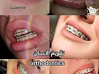 تقويم أسنان في وادي الذهب - خدمات طبية في حمص