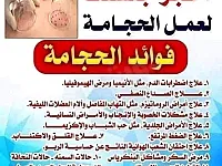 الضياء للخدمات التمريضية 