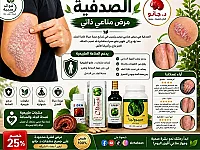 علاج مشاكل الصدفية