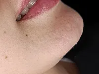 ✨عروض تجميل حصرية في مركز تريندي بالشعلان بأسعار تنافسية✨