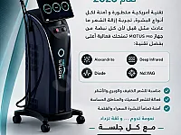 ✨ الجيل الجديد من أجهزة إزالة الشعر | MOTUS PRO