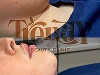 شفط اللغوغ( الذقن المزدوجة ) - Trendy beauty clinic : دمشق- الشعلان 